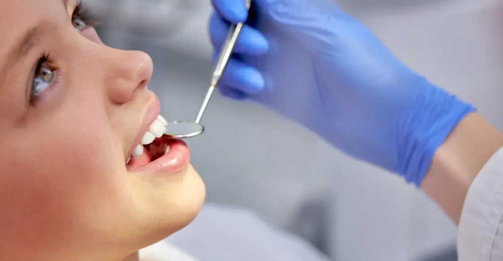 Dental Sealants - Kid Grins